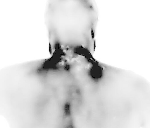 Bioespectral cervical example