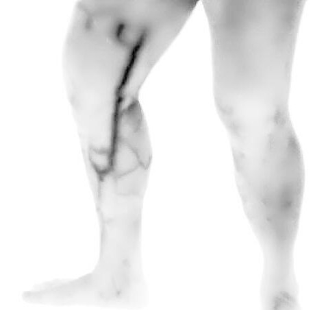 Bioespectral leg example