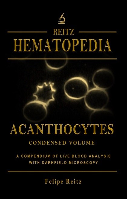 Acanthocytes — Condensed Volume