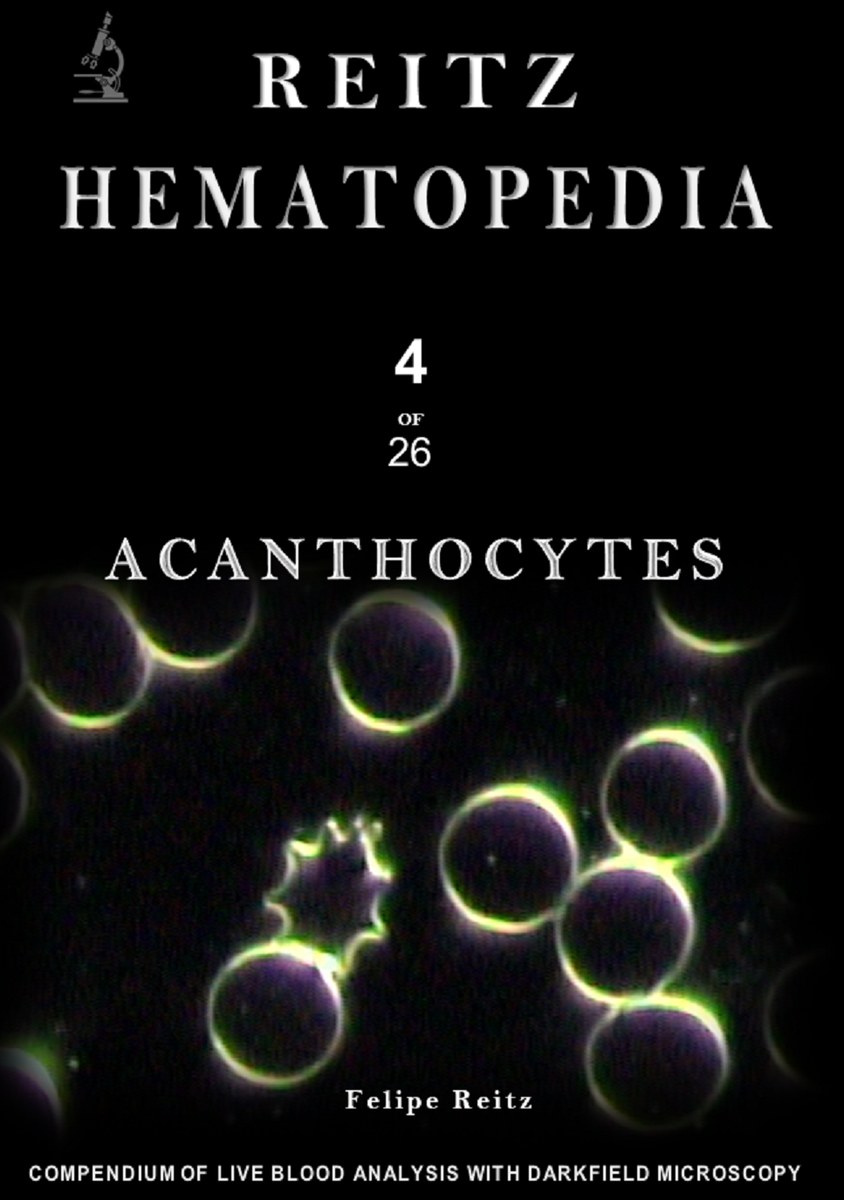 Acanthocytes — Full Version