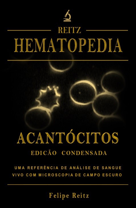 Acantócitos — Edição Condensada